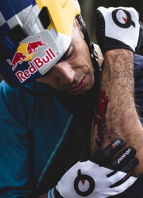 Fontana ProRider e-Vlog: Prima gara di e-Cross-country