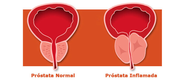 calendario mese della prevenzione prostata 2020 milano 2